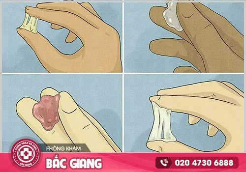 Bệnh khí hư là gì và cách chữa trị hiệu quả hiện nay?