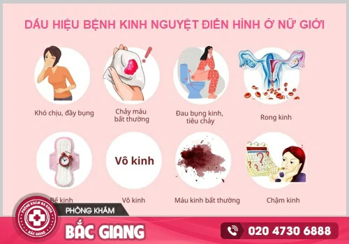 Bệnh kinh nguyệt là gì? Có nguy hiểm không?