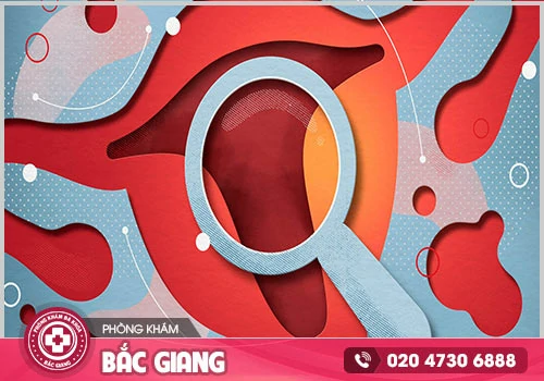 Bệnh xuất huyết tử cung cảnh báo điều gì?