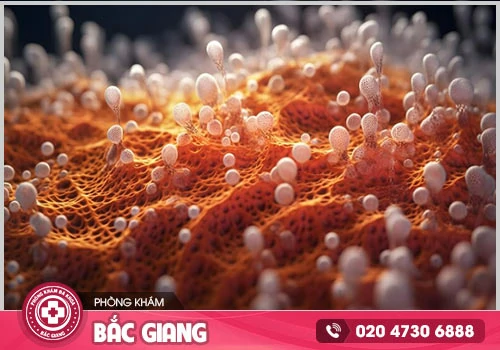 Cách điều trị nấm candida mang lại hiệu quả hiện nay là gì?