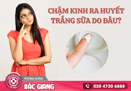 Trễ kinh ra huyết trắng sữa và những nguyên nhân bệnh lý