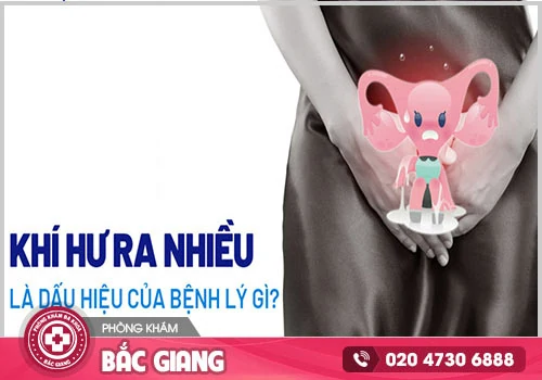 Điều gì dẫn đến khí hư ra nhiều?