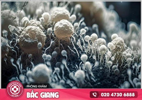 Cẩn thận với sức khỏe bằng cách khám chữa bệnh khi mắc phải nấm phụ khoa Candida 