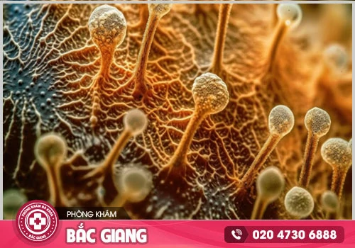 Hỗ trợ điều trị nấm Candida bằng thuốc