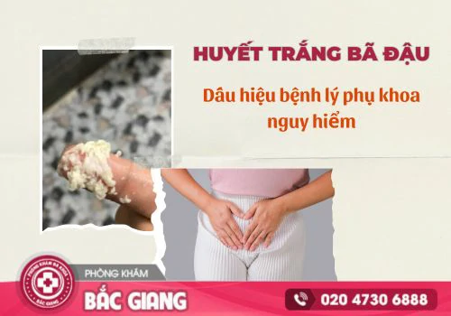 huyết trắng bã đậu