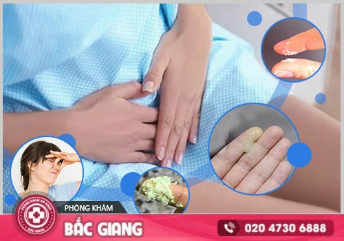 Huyết trắng bất thường - Dấu hiệu cảnh báo bệnh phụ khoa nguy hiểm
