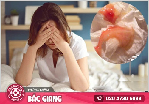 Huyết trắng có máu: Đừng chủ quan