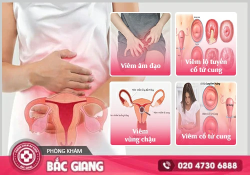 Huyết trắng đục sệt gây ra nhiều ảnh hưởng đến tâm lý và sức khỏe nữ giới. huyết trắng đục sệt