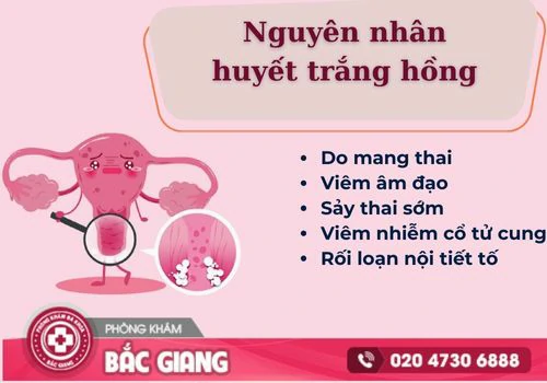 Những nguyên nhân dẫn đến tình trạng huyết trắng hồng. huyết trắng hồng