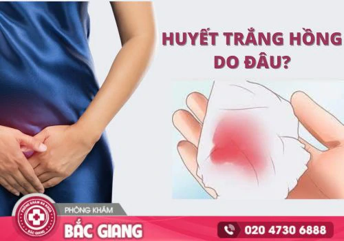 Huyết trắng hồng là dấu hiệu của nhiều bệnh lý nguy hiểm. huyết trắng hồng