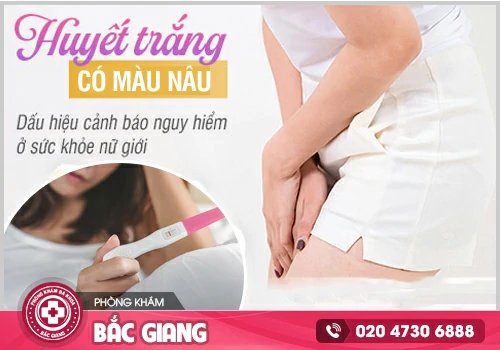 Huyết trắng màu nâu - Triệu chứng nguy hiểm khó lường