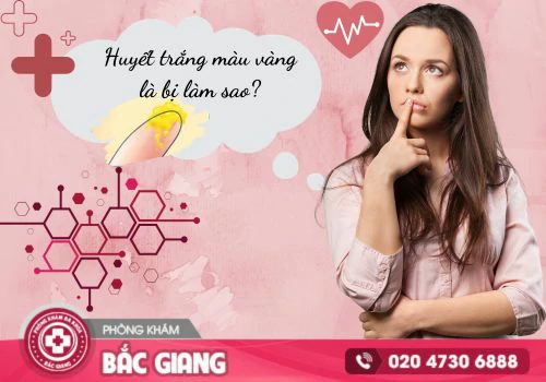 Huyết trắng màu vàng và cách điều trị hiệu quả