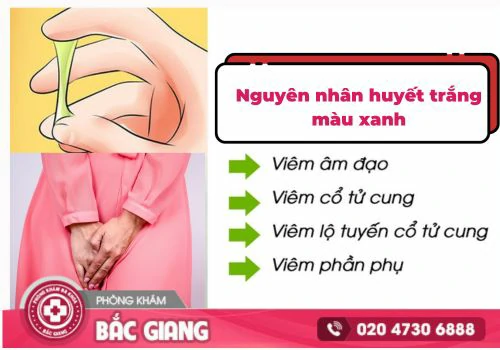 Thận trọng với hiện tượng huyết trắng màu xanh