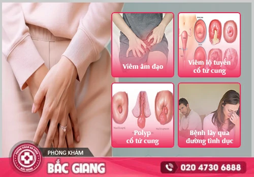 Nguyên nhân dẫn đến tình trạng khí hư màu nâu. khí hư màu nâu