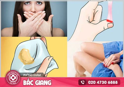 Những biểu hiện bệnh phụ khoa mà chị em không nên chủ quan