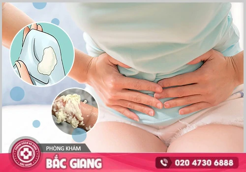Khí hư màu trắng đục là dấu hiệu gì? Phân biệt bình thường và bệnh lý