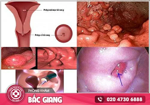 Hiện tượng kinh nguyệt đến sớm có đáng lo!