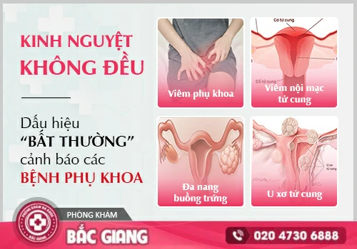 Kinh nguyệt không đều cảnh báo các bệnh phụ khoa nguy hiểm