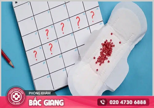 Kinh nguyệt không đều cảnh báo các bệnh phụ khoa nguy hiểm