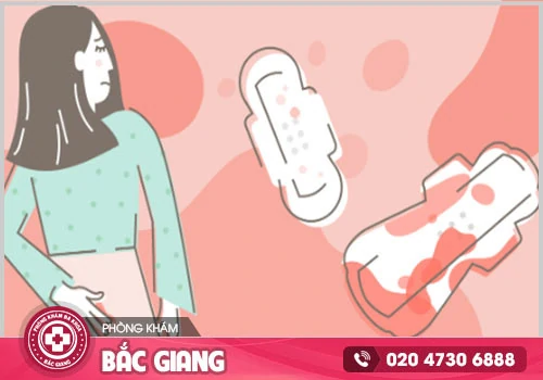 Kinh nguyệt ra nhiều lần báo hiệu điều gì?