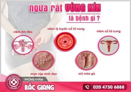 Ngứa vùng kín - Triệu chứng tiềm ẩn nhiều căn bệnh phụ khoa nguy hiểm