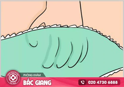 Ngứa vùng kín sau quan hệ cần cảnh giác bệnh nguy hiểm