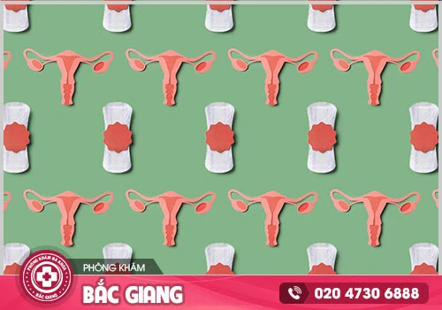 Nguyên nhân dẫn đến rong kinh ở phái nữ nên cảnh giác