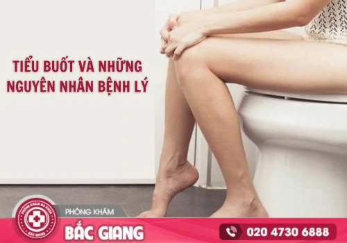 Nguyên nhân tiểu buốt và cách điều trị hiệu quả