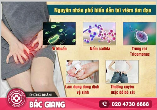 Viêm âm đạo -Bệnh phụ khoa phổ biến nhưng không thể chủ quan