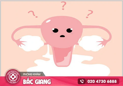 Nhận thấy khí hư có màu trắng đục giống sữa chua?