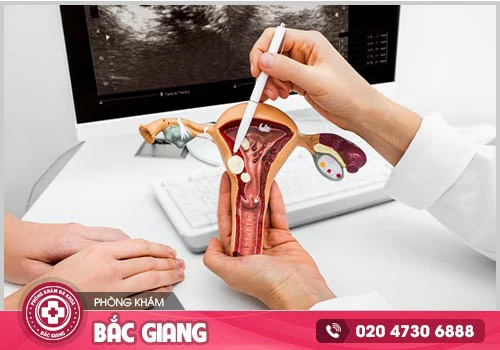 Những biểu hiện bệnh phụ khoa mà chị em không nên chủ quan