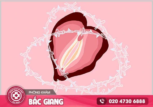 Nữ giới bị đau rát âm đạo bởi yếu tố nào gây ra?