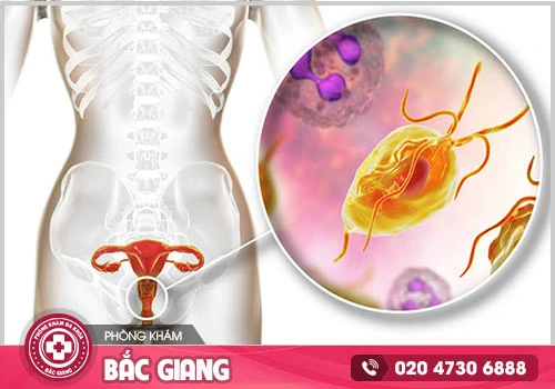 Nữ giới bị viêm nhiễm phụ khoa có có dấu hiệu nào hay không?