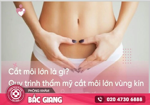 Phẫu thuật cắt môi lớn - Bí quyết giữ gìn thanh xuân cho chị em