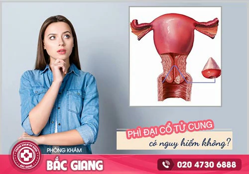 Phì đại cổ tử cung là gì? Nguyên nhân, Biến chứng và Địa chỉ điều trị
