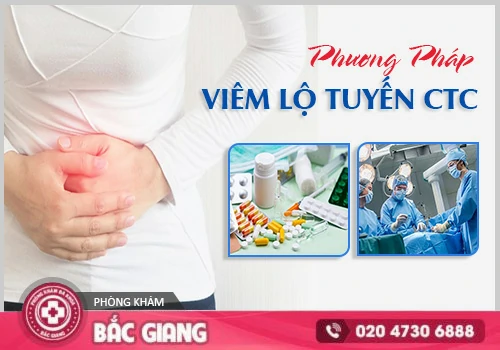Viêm Lộ Tuyến Cổ Tử Cung Là Gì? Dấu Hiệu Và Cách Điều Trị Hiệu Quả