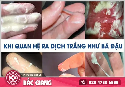 Nguyên nhân vùng kín bị ngứa ra dịch trắng vón cục