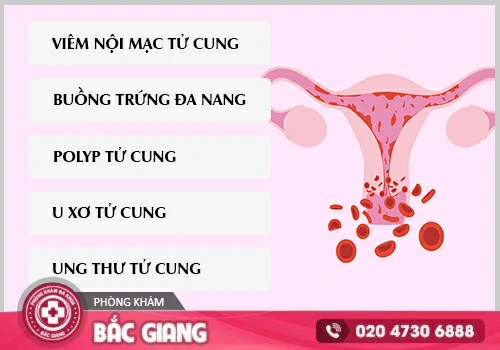 Rong kinh - Mối hiểm họa khôn lường đối với sức khỏe nữ giới