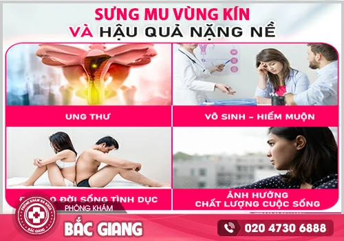 Sưng mu vùng kín là dấu hiệu nhận biết bệnh gì?