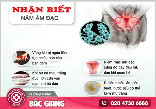 Dấu hiệu nhận biết nấm candida âm đạo