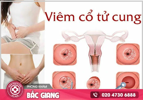 Tiêu chí lựa chọn đúng phòng khám phụ khoa an toàn, chất lượng