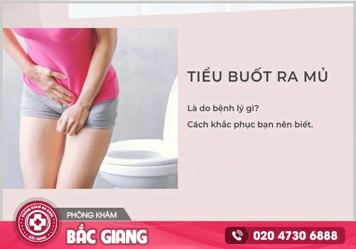 Tiểu mủ ở nữ và nam giới cảnh báo mắc bệnh lý nguy hiểm