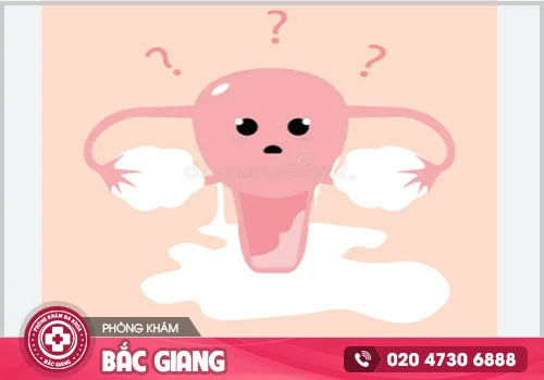 Khí hư màu trắng đục là dấu hiệu gì? Phân biệt bình thường và bệnh lý