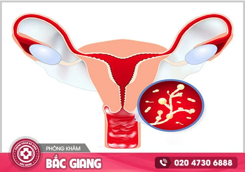 Vì sao nữ giới bị ngứa âm đạo sau quan hệ?