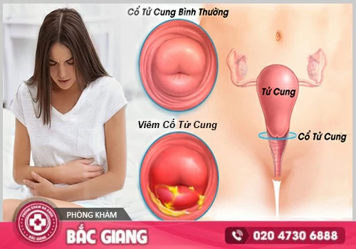 Trễ kinh nguyên nhân do đâu? Có nguy hại gì không?