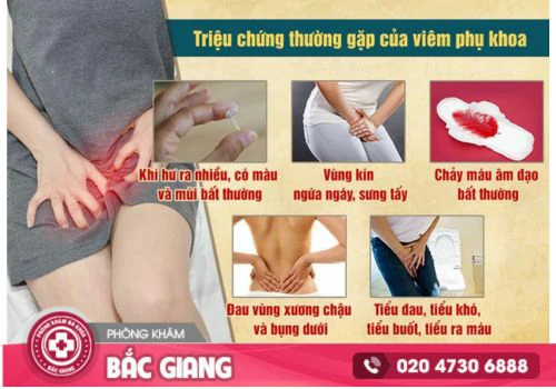 Viêm phụ khoa và những dấu hiệu cảnh báo bệnh chị em không nên chủ qua