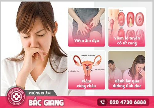 Vùng kín có mùi - Nỗi ám ảnh của nhiều chị em