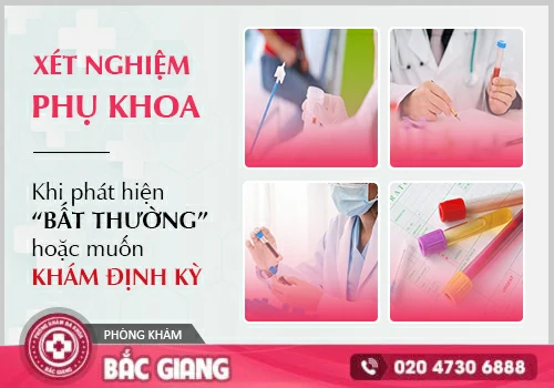 Xét nghiệm phụ khoa tại Phòng Khám Đa Khoa Bắc Giang