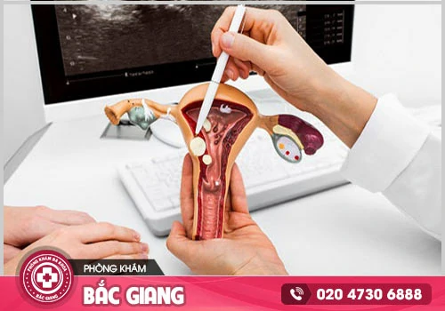 Hỗ trợ thăm khám và điều trị khí hư màu nâu hiệu quả tại Đa Khoa Bắc Giang 