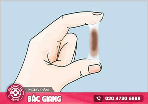 Yếu tố nào gây nên khí hư màu nâu ở nữ giới?